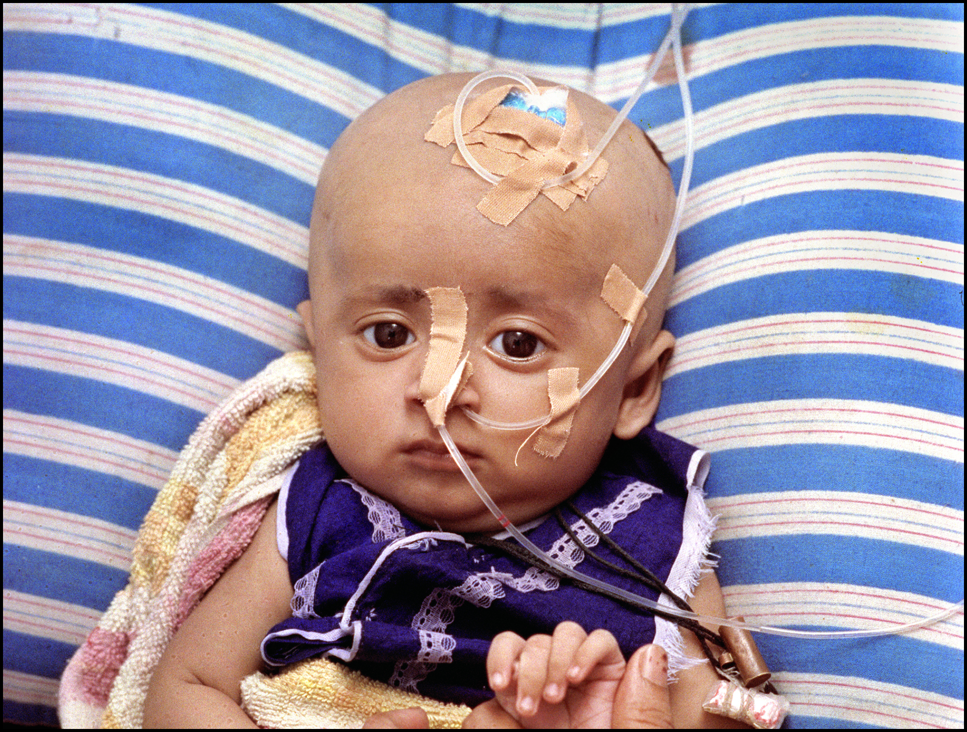 'Bangladesh Baby' Chittagong, Bangladesh 1991